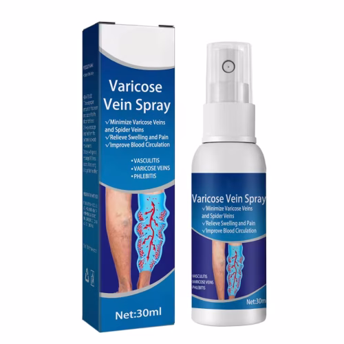 Varicose Vein