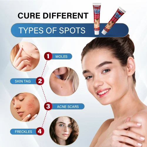 Sumifun Body Care Cream Effective Wart, Skin Tag & Mole Removal | Genital Wart Treatment | 100% Herbal Ointment