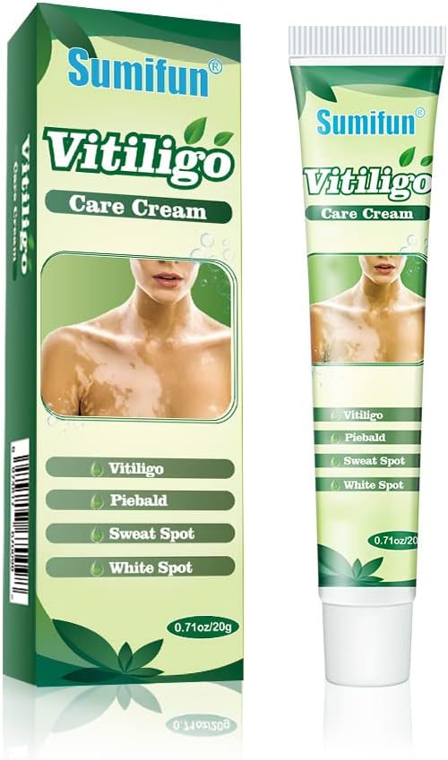 Sumifun Vitiligo Cream Reduces White Spots and Improves Skin Pigmentation 20gram