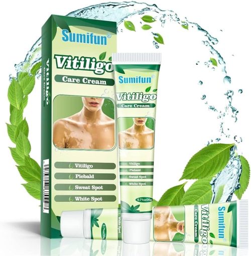 Sumifun Vitiligo Cream Reduces White Spots and Improves Skin Pigmentation 20gram