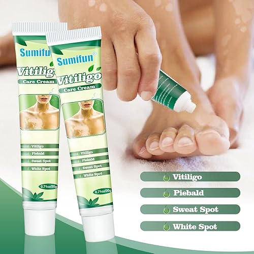 Sumifun Vitiligo Cream Reduces White Spots and Improves Skin Pigmentation 20gram
