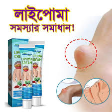 South Moon Lipoma Removal Cream Lipolysis Fat Lump Relieve Plaster Skin Swelling Ointment Subcutaneous Lumps Dredge Dissipate Body Care（20g）