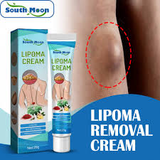 South Moon Lipoma Removal Cream Lipolysis Fat Lump Relieve Plaster Skin Swelling Ointment Subcutaneous Lumps Dredge Dissipate Body Care（20g）