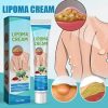 South Moon Lipoma Removal Cream Lipolysis Fat Lump Relieve Plaster Skin Swelling Ointment Subcutaneous Lumps Dredge Dissipate Body Care（20g）