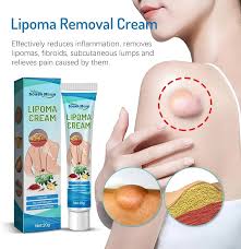 South Moon Lipoma Removal Cream Lipolysis Fat Lump Relieve Plaster Skin Swelling Ointment Subcutaneous Lumps Dredge Dissipate Body Care（20g）