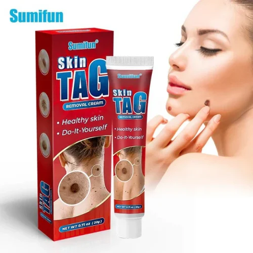 Sumifun Body Care Cream Effective Wart, Skin Tag & Mole Removal | Genital Wart Treatment | 100% Herbal Ointment