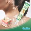 Sumifun Vitiligo Cream Reduces White Spots and Improves Skin Pigmentation 20gram
