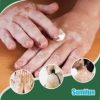 Sumifun Vitiligo Cream Reduces White Spots and Improves Skin Pigmentation 20gram